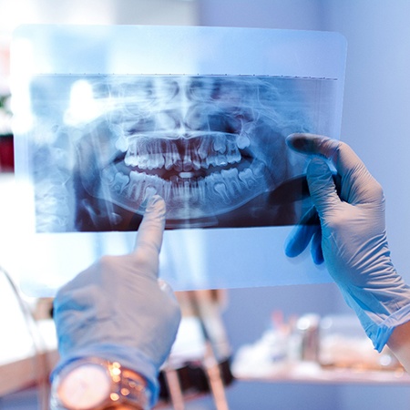 dentist pointing to X-ray after advanced dental implant procedure in Louisville  