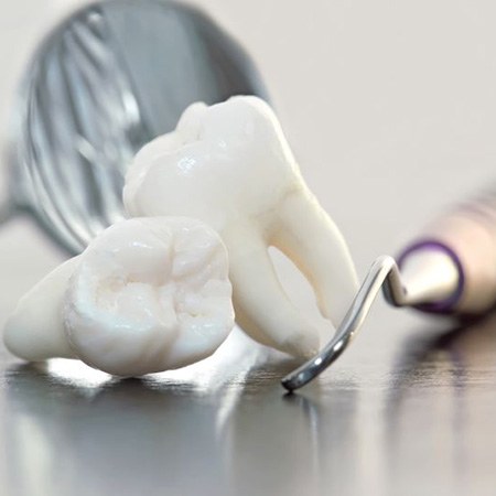 Close-up of two extracted teeth next to dental instruments